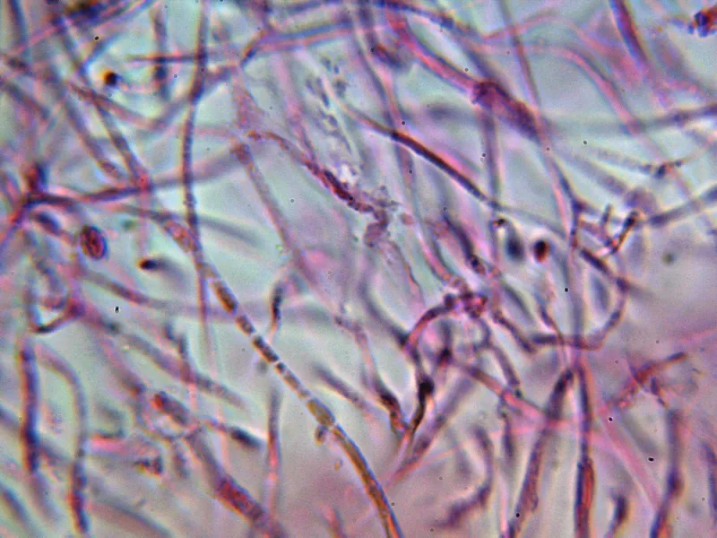Ascocoryne sarcoides 11 - Hifas contexto